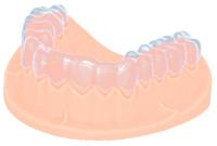 Aufbissschiene