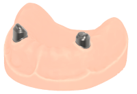Teleskope